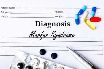 Marfan Syndrom. Bildquelle: Von Marcelo Ricardo Daros / Shutterstock.com
